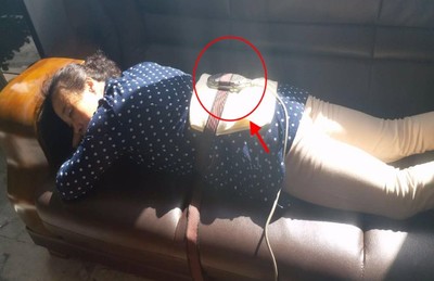 腰间盘突出怎么治好的快,铁腰板真的能治疗腰间盘突出吗