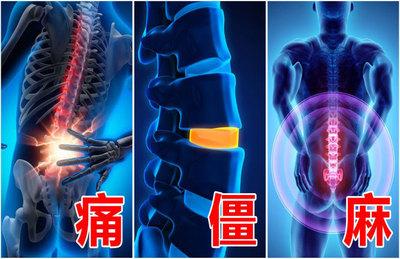腰椎间盘突出的六大症状的什么?什么方法治疗比较好呢?